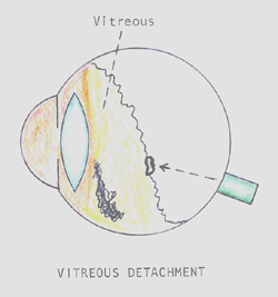 diagram over øyet